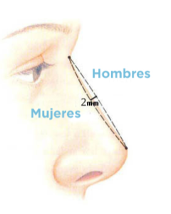 Armonización facial