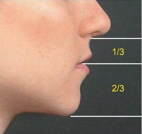 Armonización facial